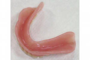 コンフォート義歯