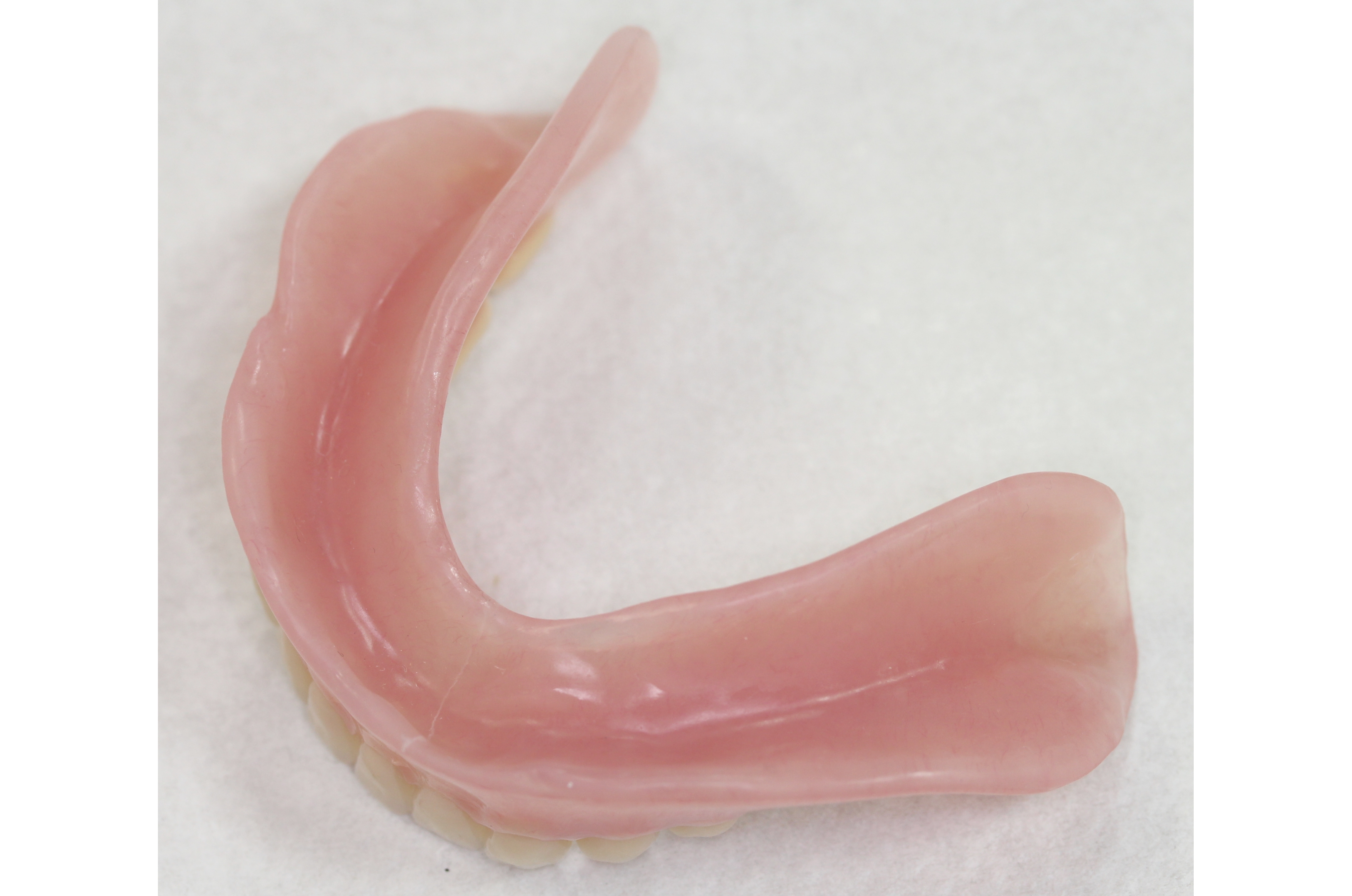 コンフォートデンチャー